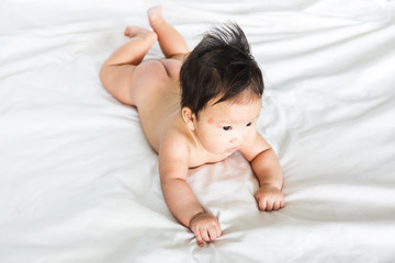 Asian baby girl with red spots on skin face