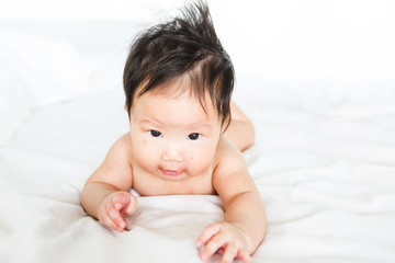Asian baby girl with red spots on skin face