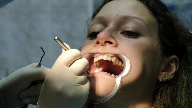 Installation and fixing of metal braces. Visit to orthodontist dentist, bite correction close-up