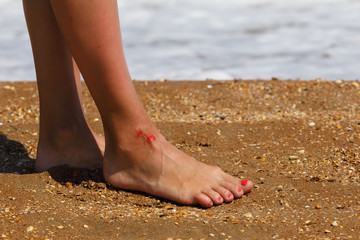 Fototapeta na wymiar Wound on the leg as a sign of not attentive behavior on the beach