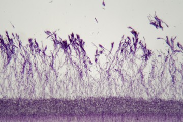 Microscope photo a bundle of Penicillium fungi