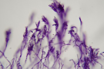 Microscope photo a bundle of Penicillium fungi