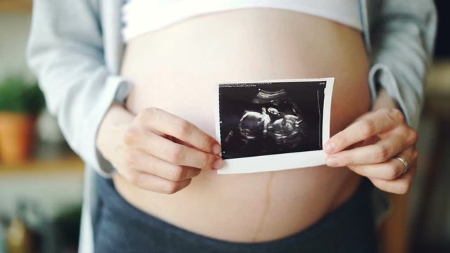 Close-up shot of pregnant woman's belly and female hands holding ultrasound image of healthy unborn child. Pregnancy, medical care and happy family concept.