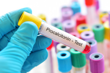 Blood sample tube for procalcitonin test, diagnosis for severe sepsis
