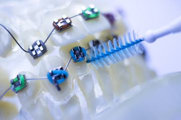 Interdental teeth brackets clean