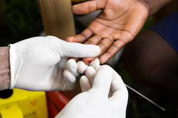 a health worker doing a finger prick test for HIV. He is drawing blood into a capillary tube after...