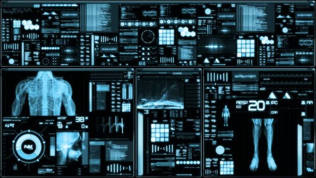 Blue futuristic patient monitor screen in perspective / Medical screen interface. Screen with various parameters measured. ST-segment and heart attack detection, pace-maker analysis, and arrhythmia an