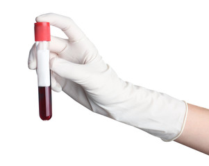 Doctor holding glass tube with blood on white background, closeup. Allergy test