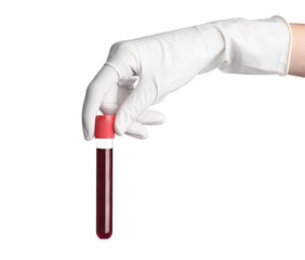 Doctor holding glass tube with blood on white background, closeup. Allergy test
