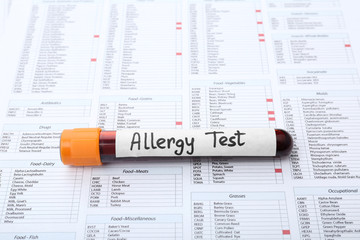 Glass tube with blood on document. Allergy test
