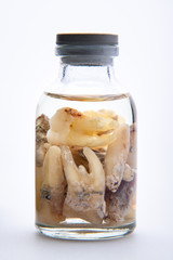 Concept - dentist's trophy. Set of removed teeth in a glass medical vial with ethyl alcohol. Macro...