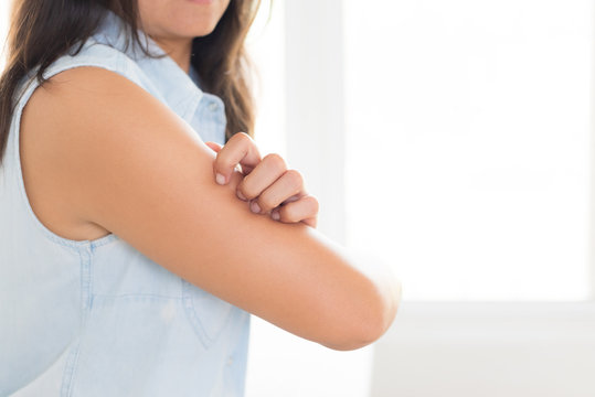 Close up woman arm scratch the itch by hand at home. Healthcare and medical concept.