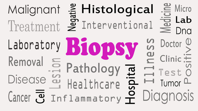 Biopsy concept word cloud on white background.