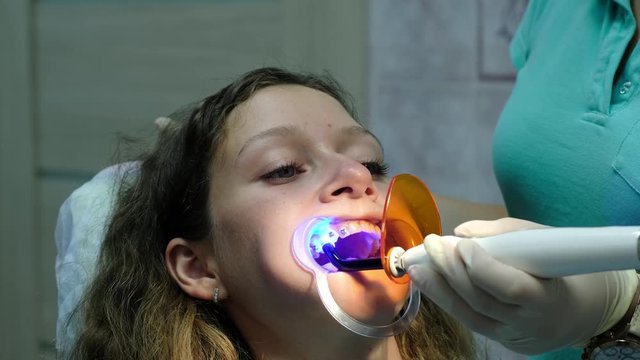 Visit to the dentist, installation of the bracket system. The assistant shines with a dental polymerization ultraviolet lamp to fixation the brackets close-up.