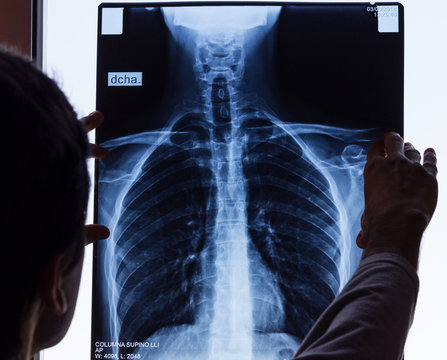 Doctor checking on chest X-ray. Man holding radiography looking at it. Spinal column exam, anatomy, science, profession, work, patient accident concepts. Language translation: right