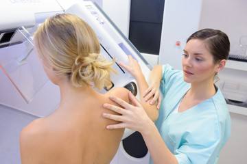 having a mammogram examination - obrazy, fototapety, plakaty