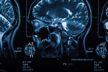 The X-ray of the human brain
