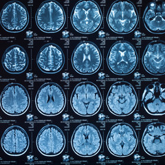 The X-ray of the human brain