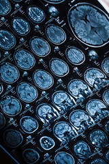 The X-ray of the human brain