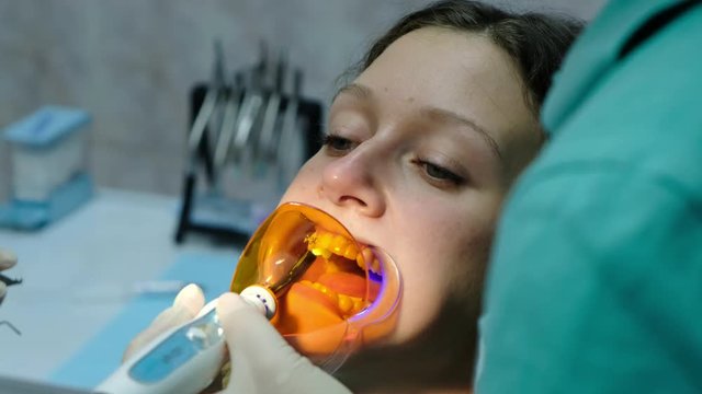 Visit to the dentist, installation of the bracket system. Assistant shines with a dental ultraviolet lamp, orthodontist sets the bracket on the tooth close-up.