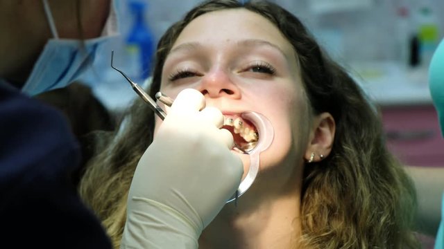 Visit to the dentist, correction of malocclusion, treatment teeth. Orthodontist checks the installed braces in the mirror close-up.