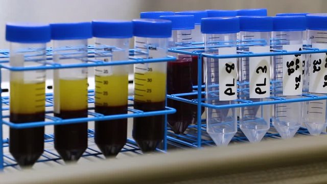 Bokeh Blur to Focused Stage One Seperated Blood in Conical Centrifuge Tubes Under a Sterile Hood in a Lab - Platelet Rich Plasma and Red Whole Blood