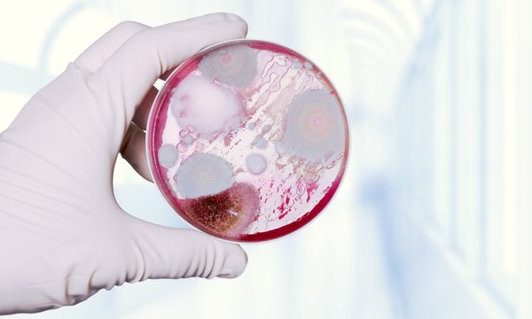 Microbiology laboratory test in scientist hand on background