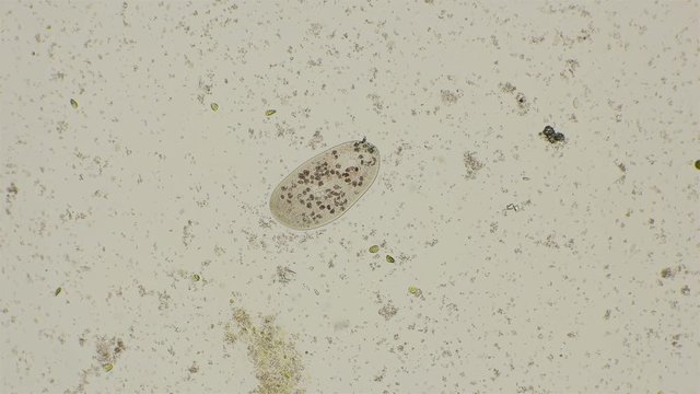 Infusoria feeding on bacteria Archea acquired a pink hue, under a microscope