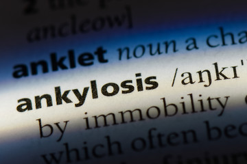 Obraz premium ankylosis