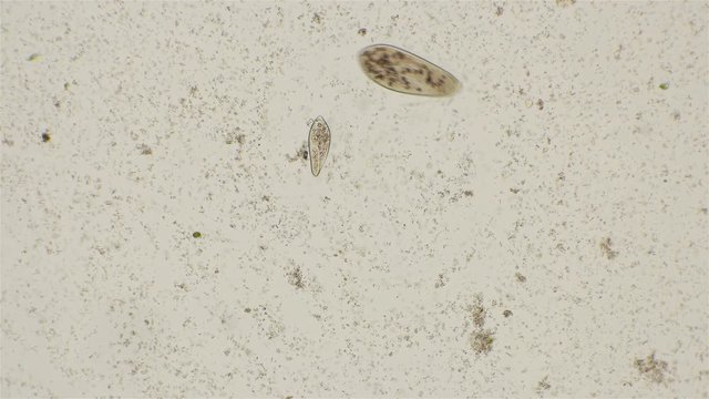 Infusoria feeding on bacteria Archea acquired a pink hue, under a microscope