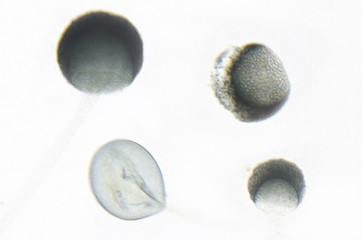 Microscope photography of Rhizopus
