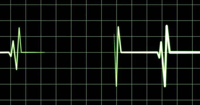 ECG, electrocardiogram showing a heart rate, diagnostic device in hospital, heart beat, medical check-up, vital signs data screen, life, artwork in medicine, green sound wave on black, 4k loop