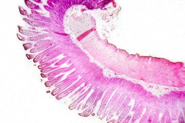 Microscopy photography. Small intestine transversal section.