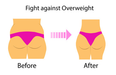 Vector illustration with two types of figure, overweight problem