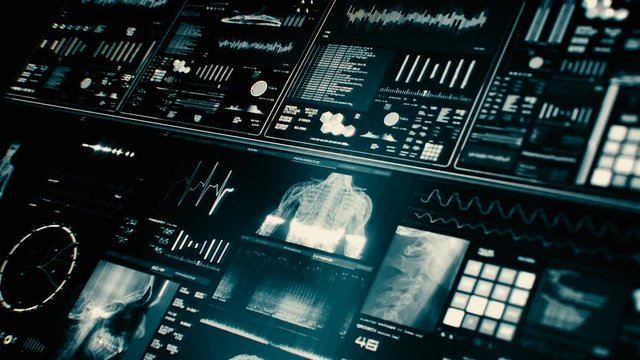 Futuristic patient monitor screen in perspective / Medical screen interface. Screen with various parameters measured. ST-segment and heart attack detection, pace-maker analysis, and arrhythmia analysi