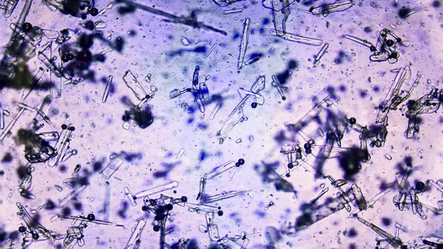 Salt, sugar and soda filmed under a microscope