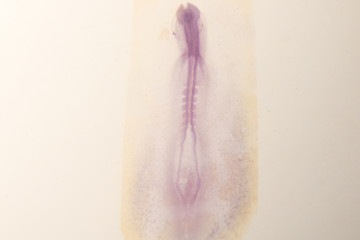 Development of the embryo chicken,The development of the chick on the slide under microscope.