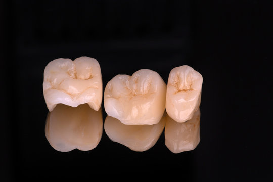 dental ceramic veneers and crowns isolated with mirror background.