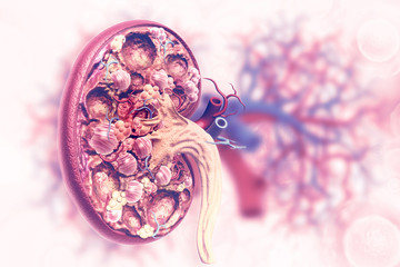 Kidney disease - obrazy, fototapety, plakaty