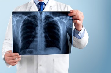 Doctor looking chest x-ray film.
