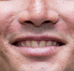 male dirty teeth macro