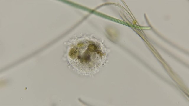 testate amoeba under the microscope