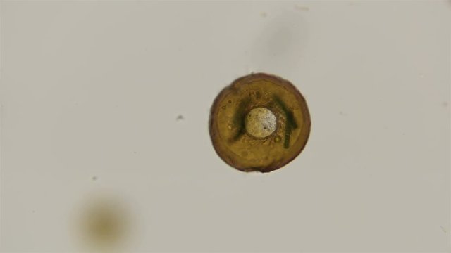 testate amoeba Arcella under the microscope