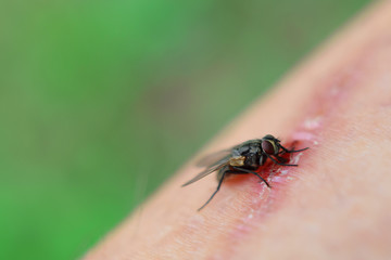 Fototapeta premium Fly Muscidae on healing wound on injured human body skin surface closeup view with copy space for text on blurred green grass background. Threat of infection and healthcare concept.