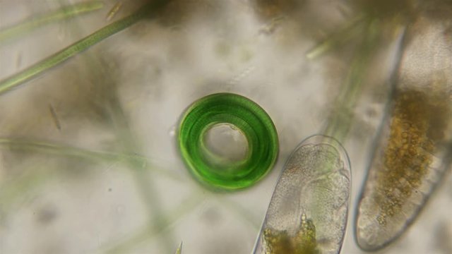 algae Planktolyngbya kontorta, which are twisted in a ring, under a microscope
