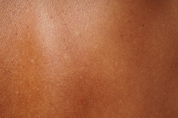 close-up human skin damged by age and sun tanning