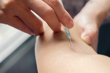 Close up pricking needle syringe in the arm patient blood sample for blood test