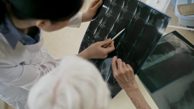 Top view of senior female doctor and young colleague pointing with pens at x-ray image and discussing results