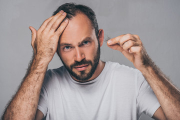 bearded middle aged man holding fallen hair and looking at camera isolated on grey - obrazy, fototapety, plakaty