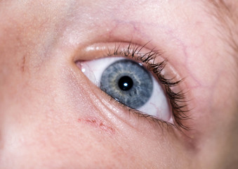 eye baby blue light for medicine body part for design
